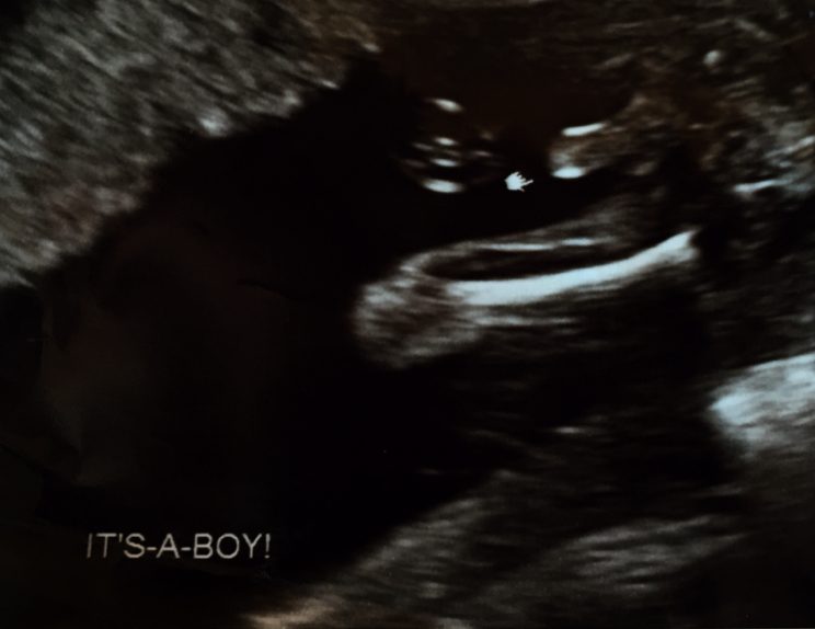 It's a Boy Ultrasound